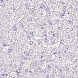 PLCD4 Antibody, Novus Biologicals 0.1mL; Unlabeled:Antibodies, Polyclonal